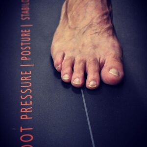 VISITA BAROPODOMETRICA